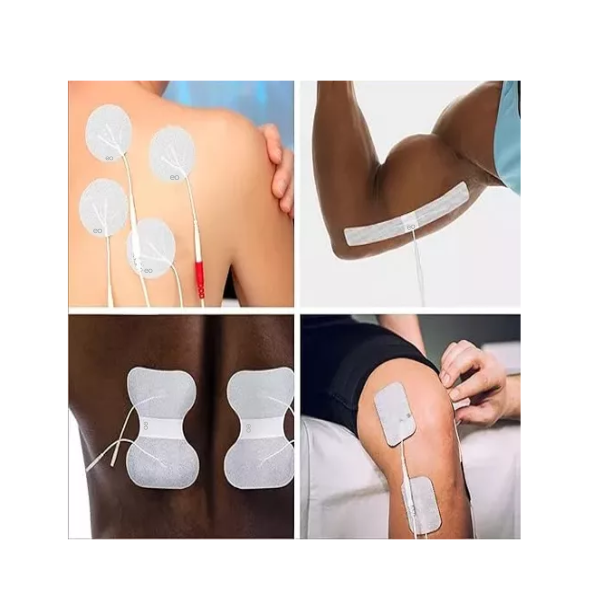 Foto 2 | Electrodos 3cm Faciales Fisioterapia 50 Pzas Eo Safe Imports Esi-16570-1 Blanco