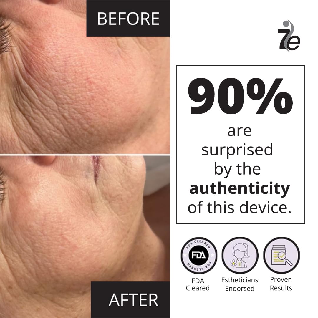 Foto 4 | Dispositivo Facial Con Microcorriente 7e Wellness Myolift Mini - Venta Internacional.