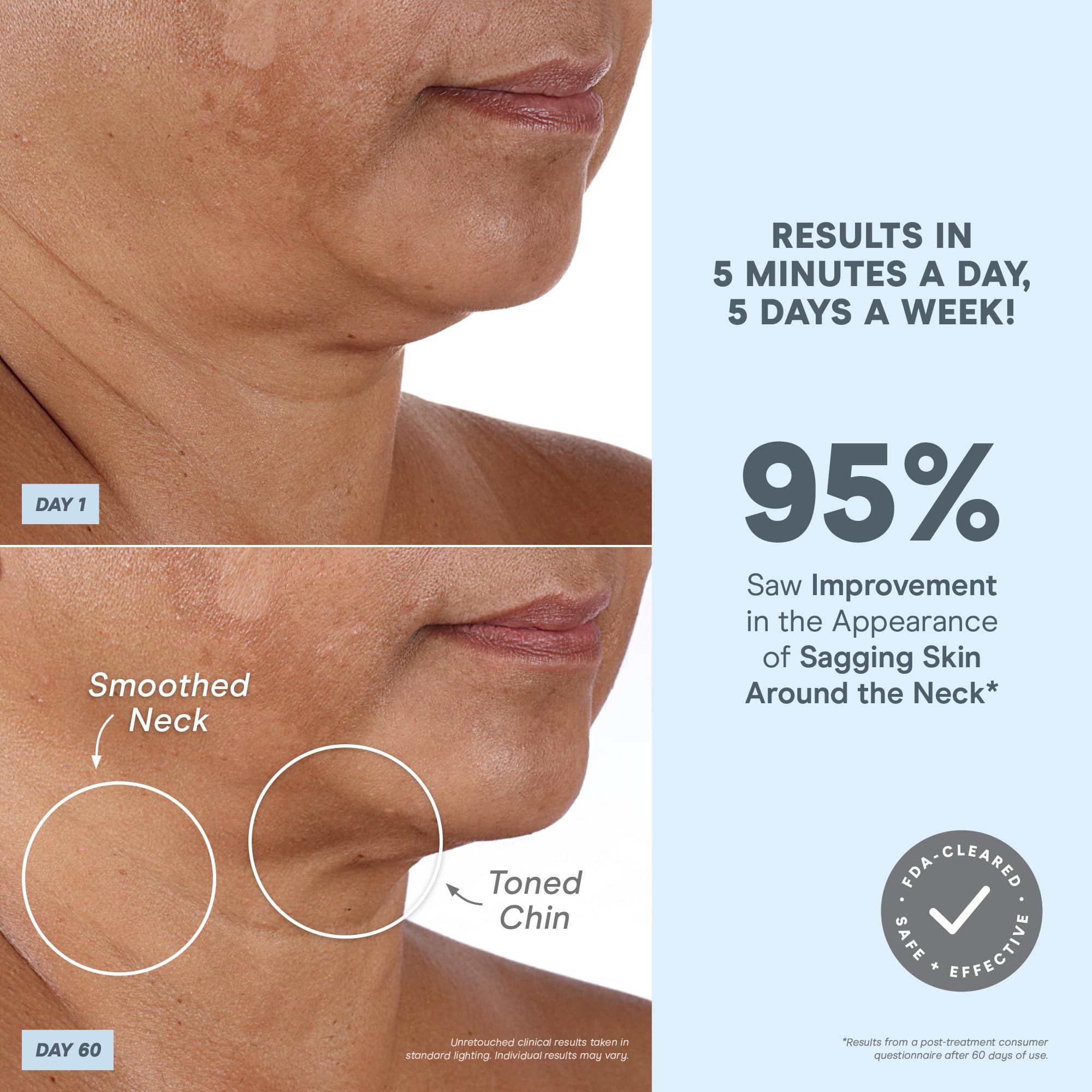Foto 3 | Dispositivo Facial Nuface Mini+ Microcurrent Con Gel Y Cepillo - Venta Internacional.