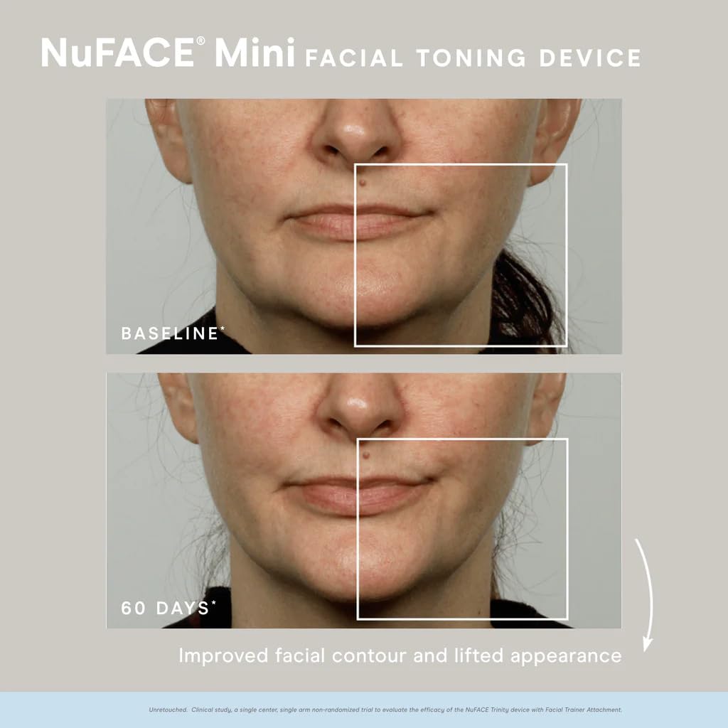 Foto 6 pulgar | Kit De Inicio Nuface Mini White Con Imprimador En Gel - Venta Internacional.