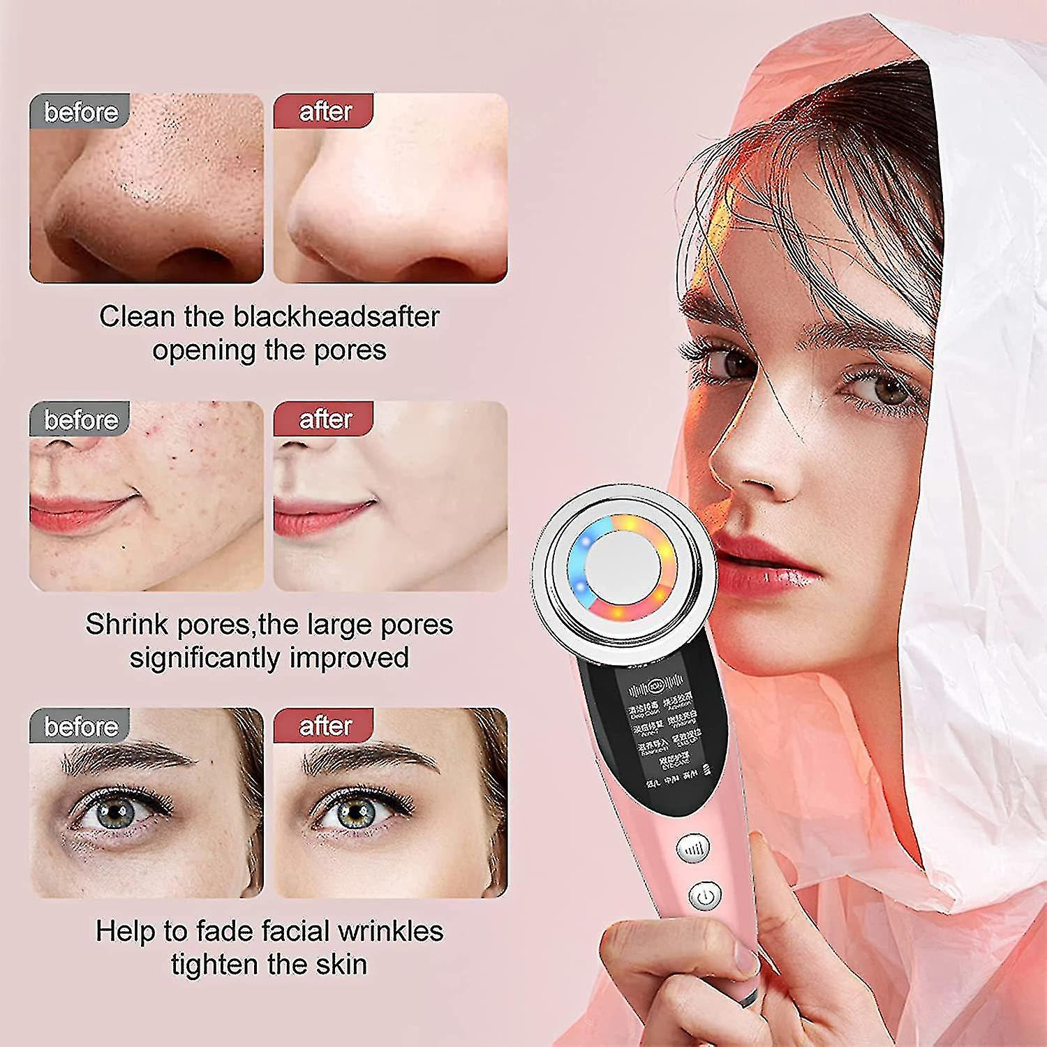 Foto 3 | Limpiadores Faciales Huoguo Photon: Dispositivo De Rejuvenecimiento De La Piel - Venta Internacional.