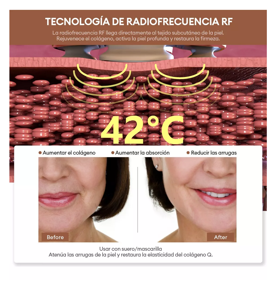 Foto 4 pulgar | Masajeador Radiofrecuencia Facial Ckeyin Ems/rf Blanco