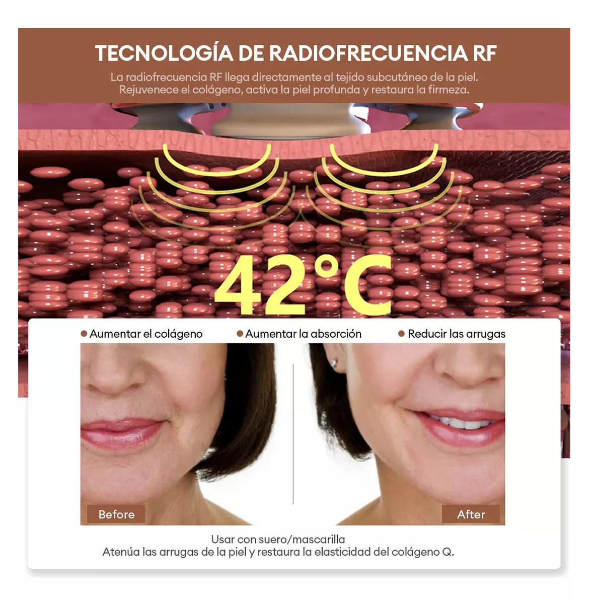 Foto 4 pulgar | Masajeador Radiofrecuencia Facial Electroporadores Ems/rf, Blanco