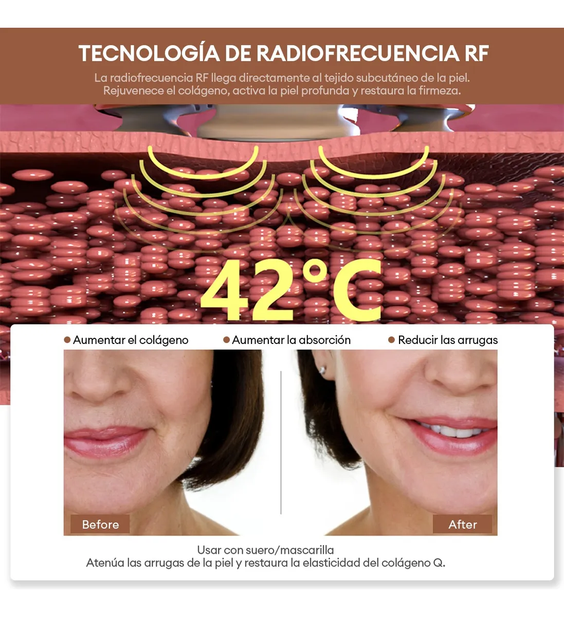 Foto 3 pulgar | Masajeador Radiofrecuencia Facial Belug Electroporadores Blanco Rosa