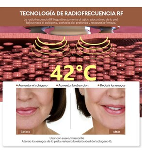 Foto 2 | Masajeador Radiofrecuencia Facial Belug Electroporadores Blanco Rosa