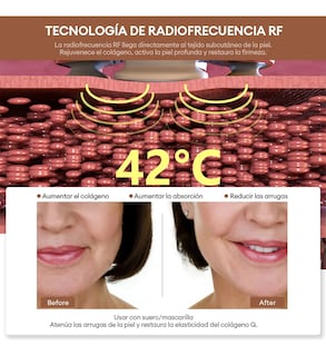 Foto 2 | Masajeador Radiofrecuencia Facial Lab.g Electroporadores Blanco Rosa