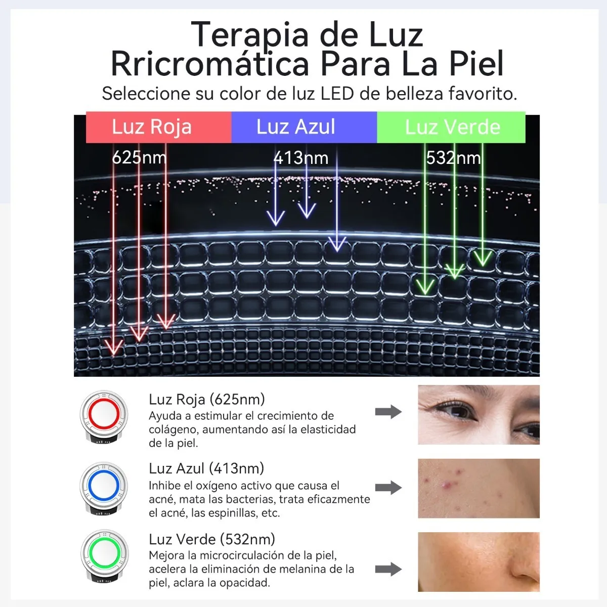 Foto 3 pulgar | Electroestimulador Facial Multifuncional Ultrasónico Blanco