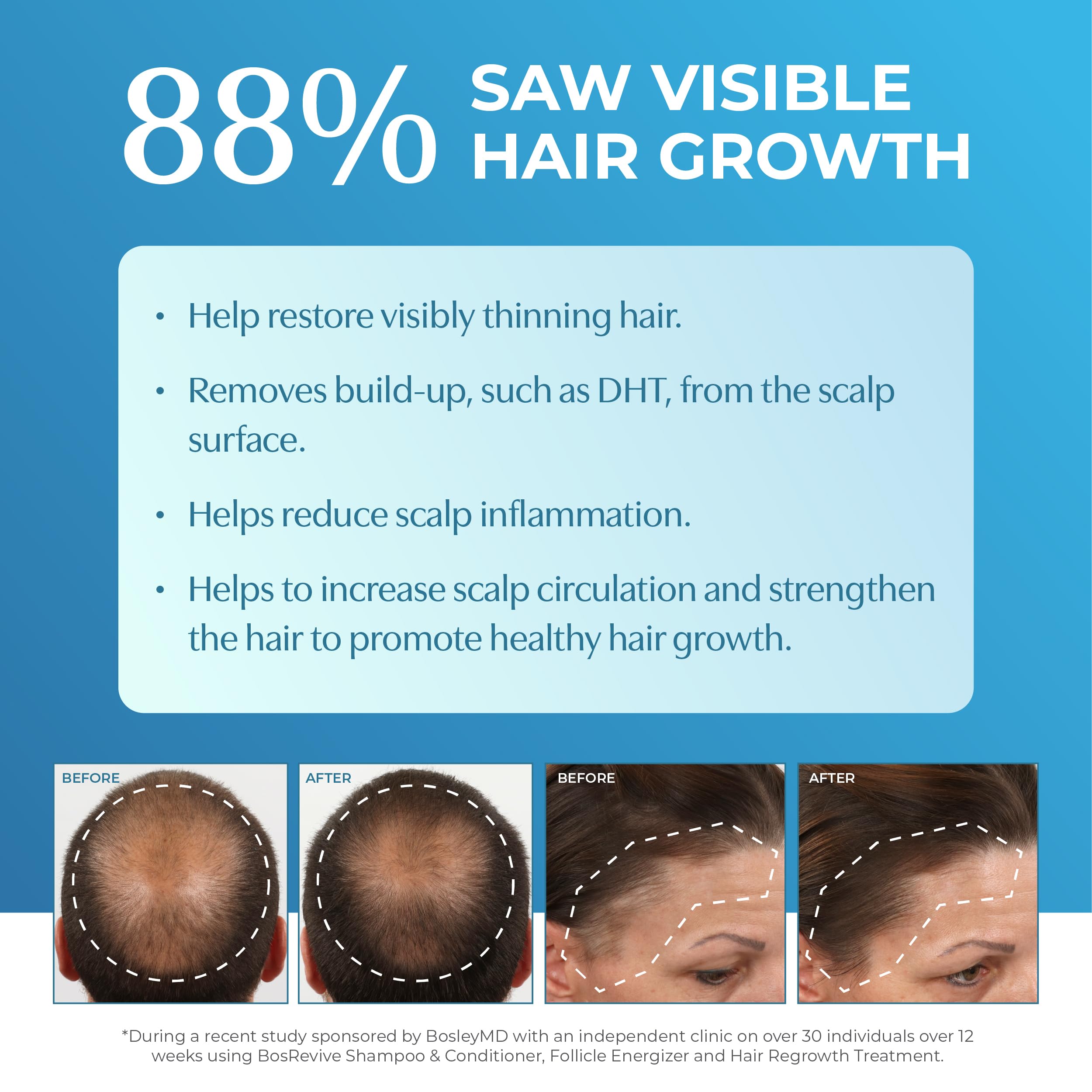 Foto 5 | Tratamiento Para El Crecimiento Del Cabello Bosleymd Professional Men 60 Ml X2 - Venta Internacional.
