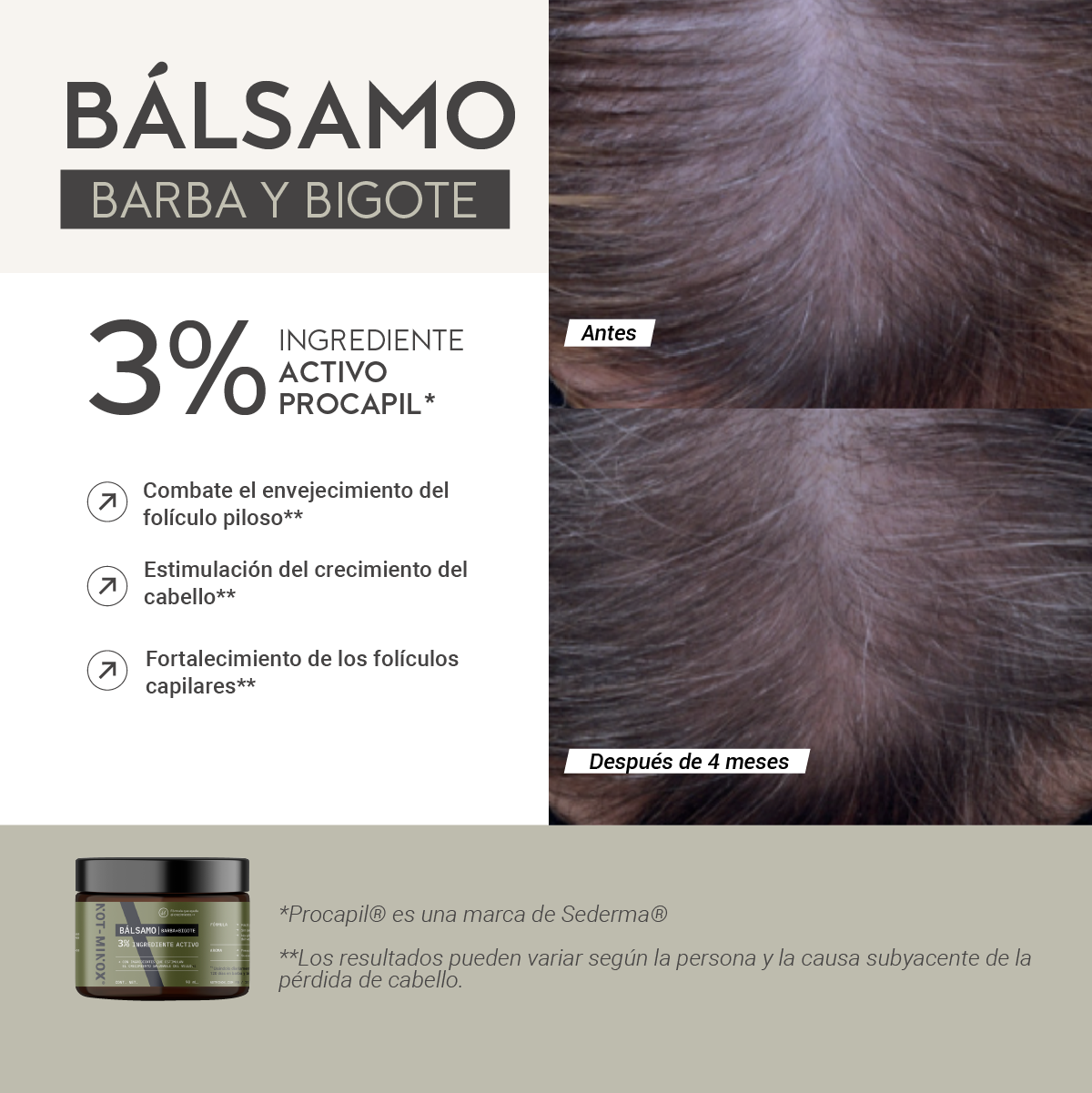 Foto 3 | Bálsamo para Crecimiento de Barba y Bigote Not-Minox 3% Ingrediente Activo 90 ml