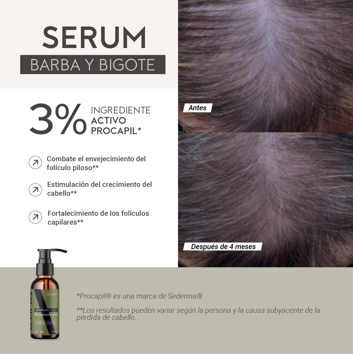 Foto 4 pulgar | Serum para Crecimiento de Barba y Bigote Not-Minox 3% Ingrediente Activo 90 ml