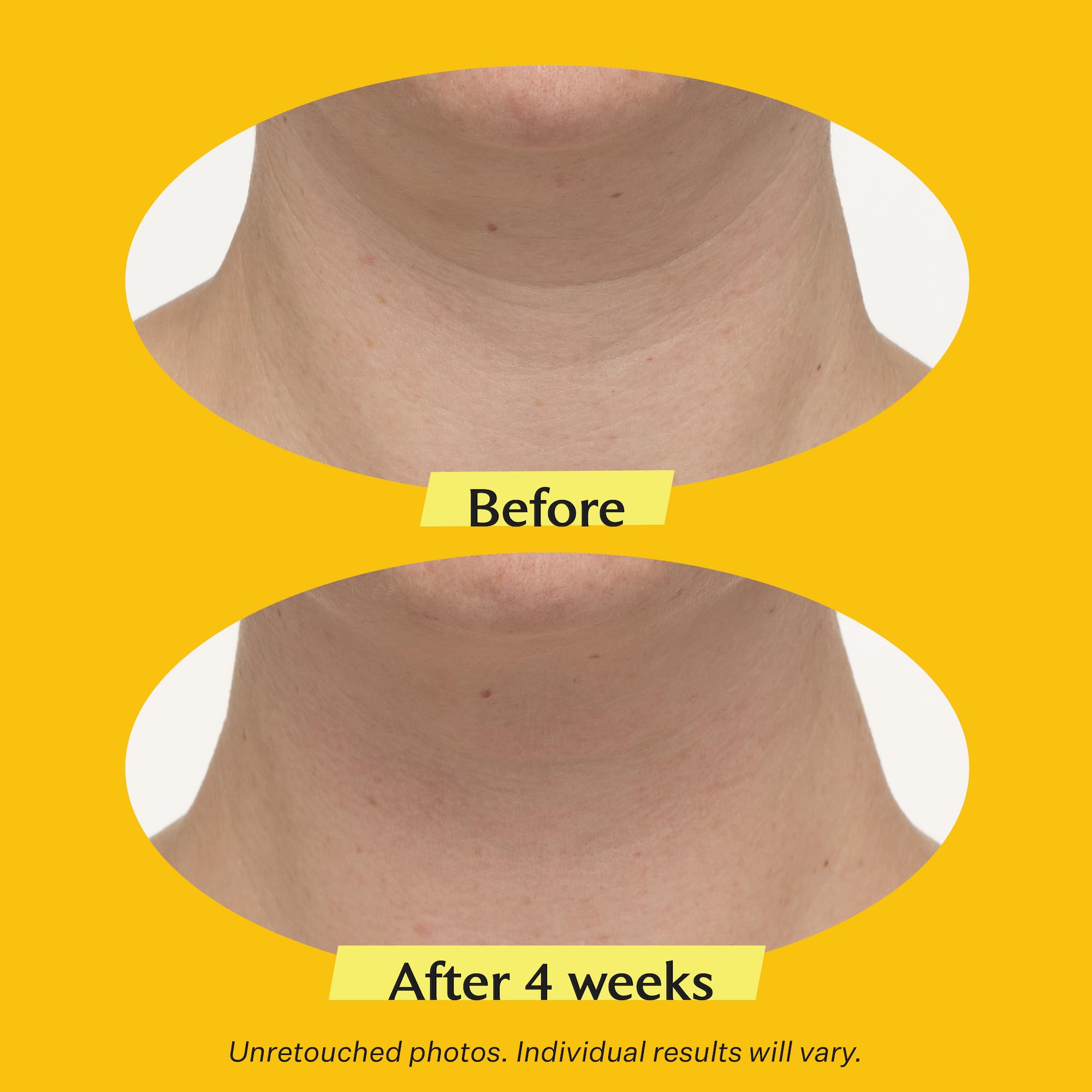 Foto 3 | Crema Para El Cuello Strivectin Tl Advanced 50 Ml - Venta Internacional.