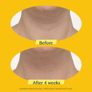 Foto 3 | Crema Para El Cuello Strivectin Tl Advanced 50 Ml - Venta Internacional.
