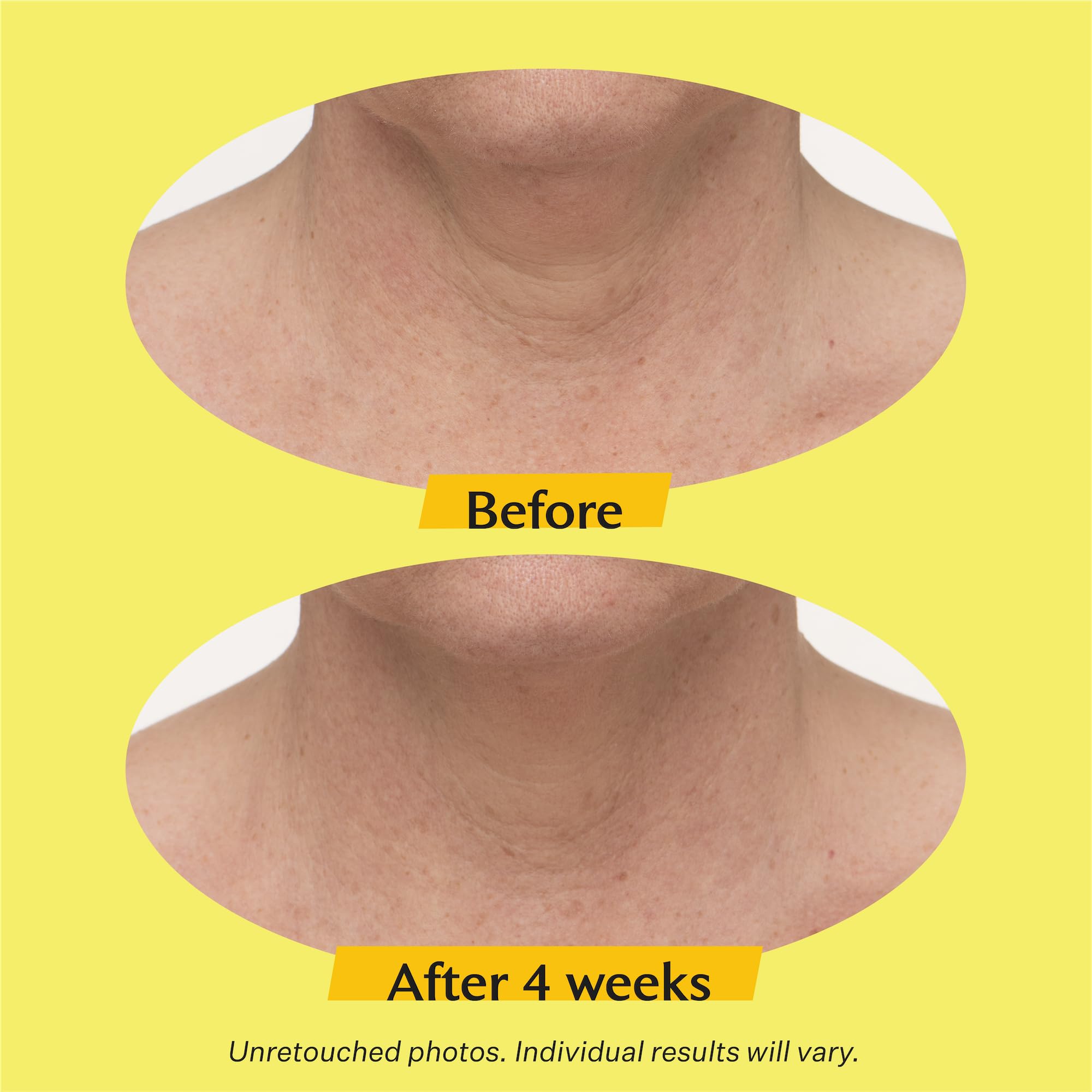 Foto 7 pulgar | Crema Para El Cuello Strivectin Tl Advanced 50 Ml - Venta Internacional.