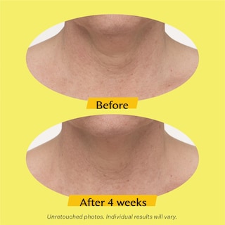Foto 6 | Crema Para El Cuello Strivectin Tl Advanced 50 Ml - Venta Internacional.