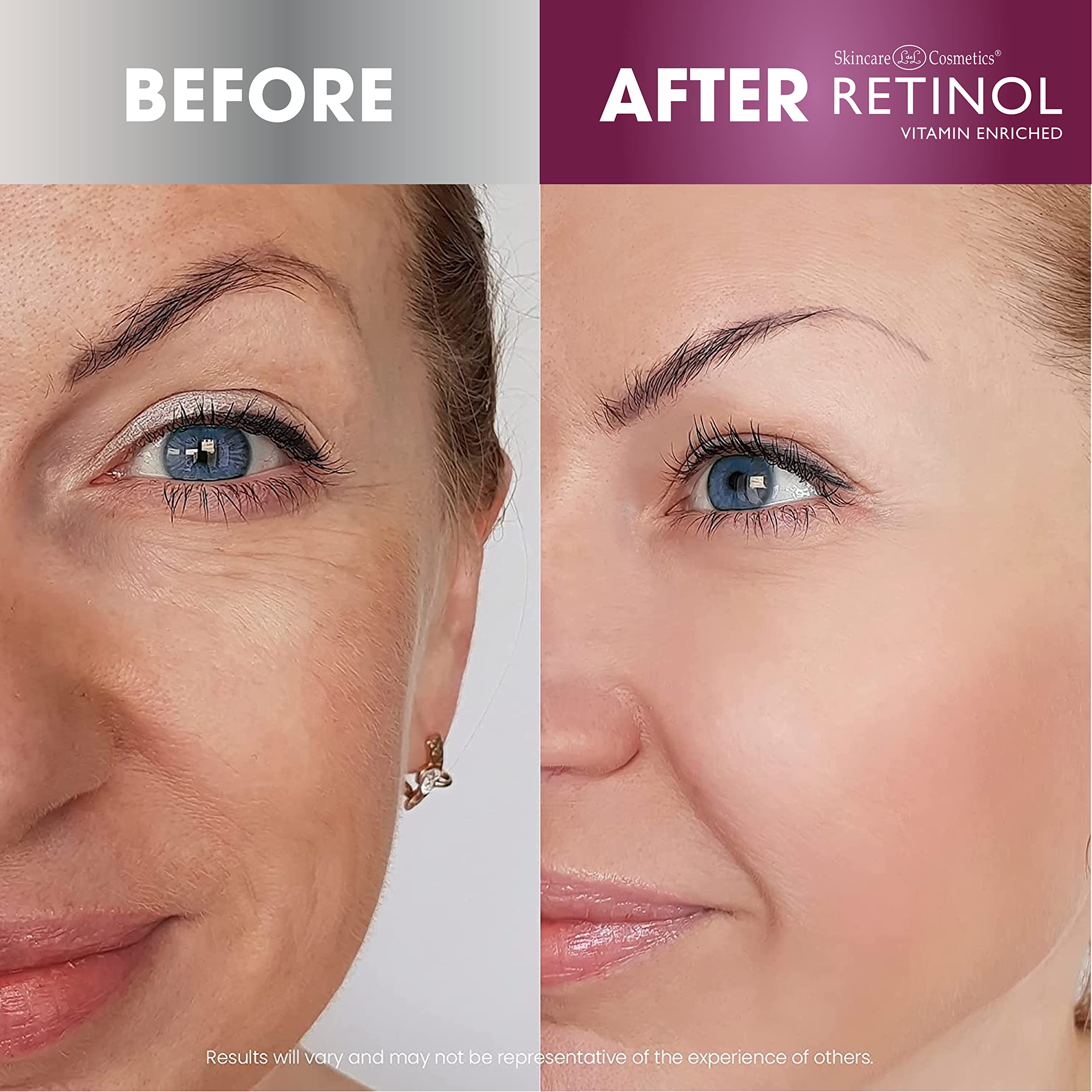 Foto 5 | Almohadillas De Gel Para Ojos, Retinol, Antienvejecimiento, El Tratamiento Antiarrugas Original - Venta Internacional.