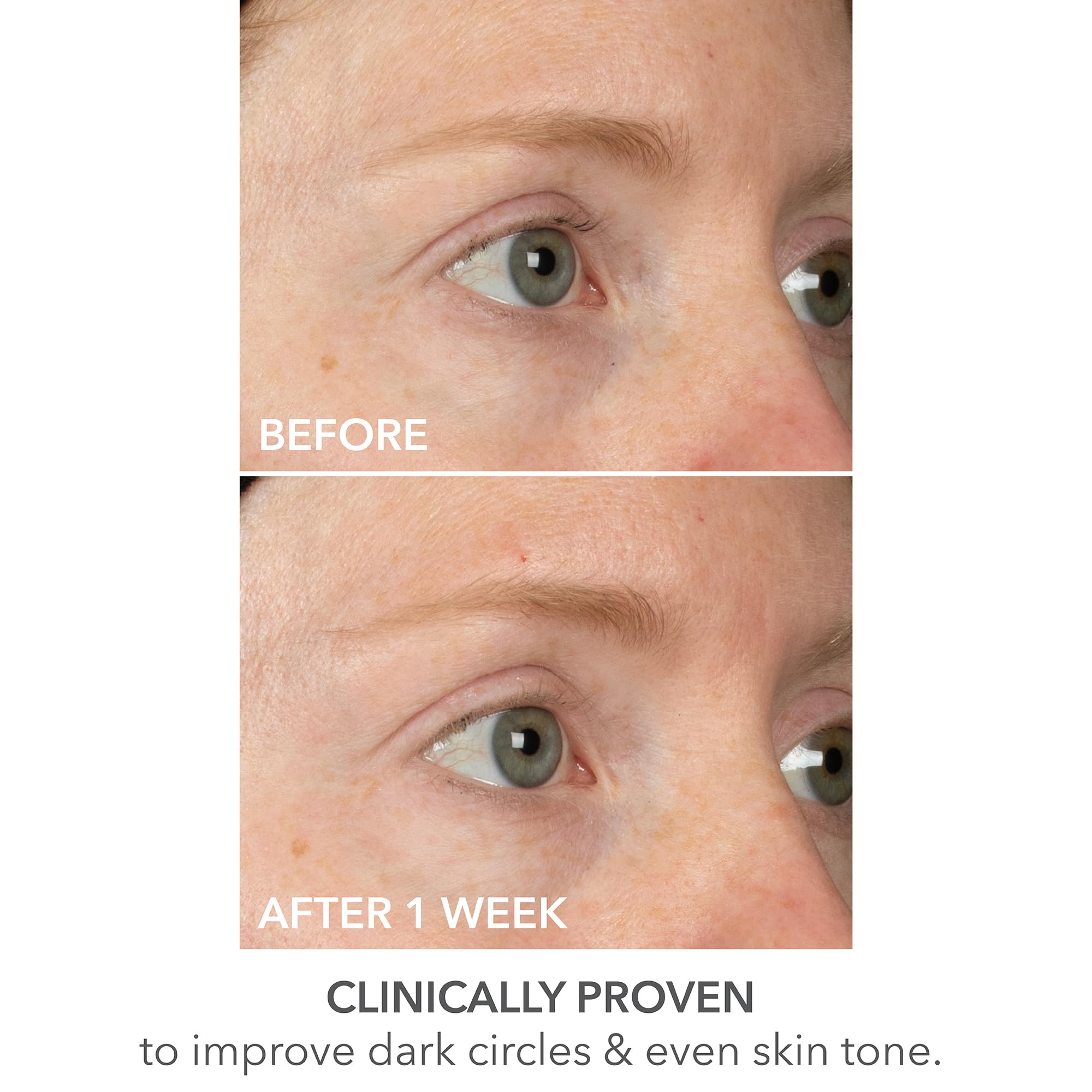 Foto 7 | Mascarilla Para Ojos Dr. Dennis Gross Derminfusions Lift + Repair - Venta Internacional.