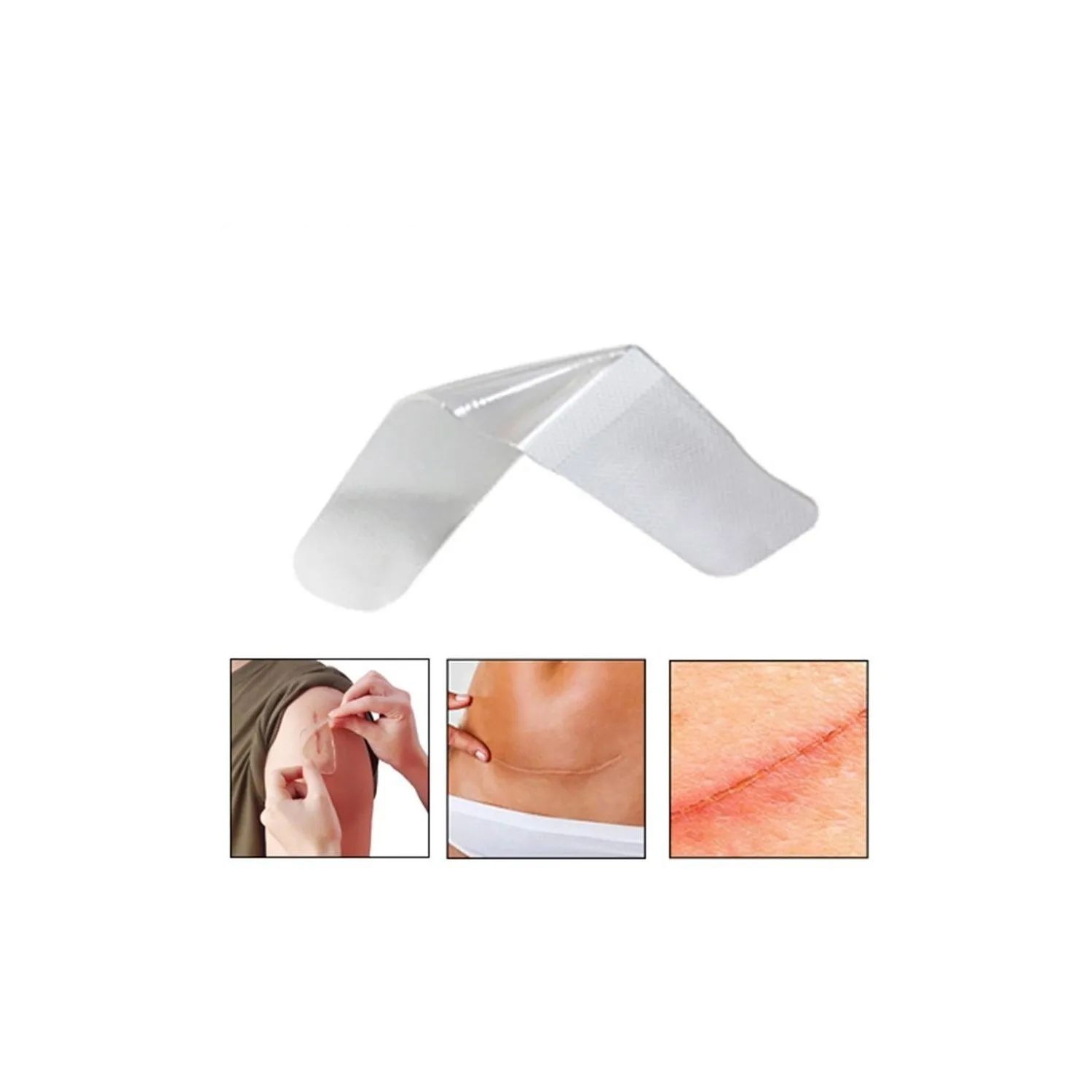 Foto 2 pulgar | Parche de Silicona para Cicatrices Hipertróficas y Queloides - Venta Internacional