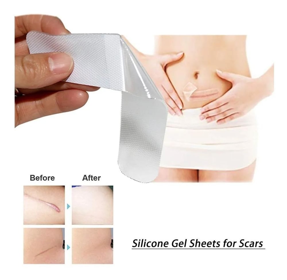 Foto 3 pulgar | Parche de Silicona para Cicatrices Hipertróficas y Queloides - Venta Internacional