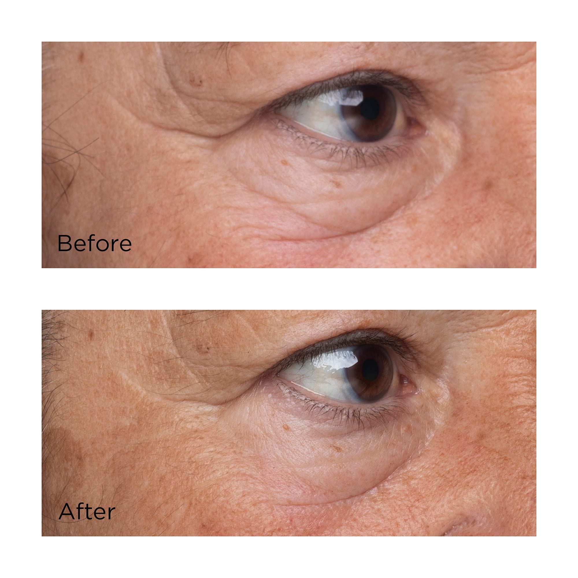 Foto 5 pulgar | Sérum Para Ojos Perricone Md, Factor De Crecimiento De Alta Potencia, 15 Ml - Venta Internacional.