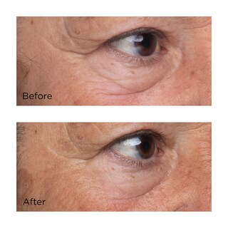 Foto 4 | Sérum Para Ojos Perricone Md, Factor De Crecimiento De Alta Potencia, 15 Ml - Venta Internacional.