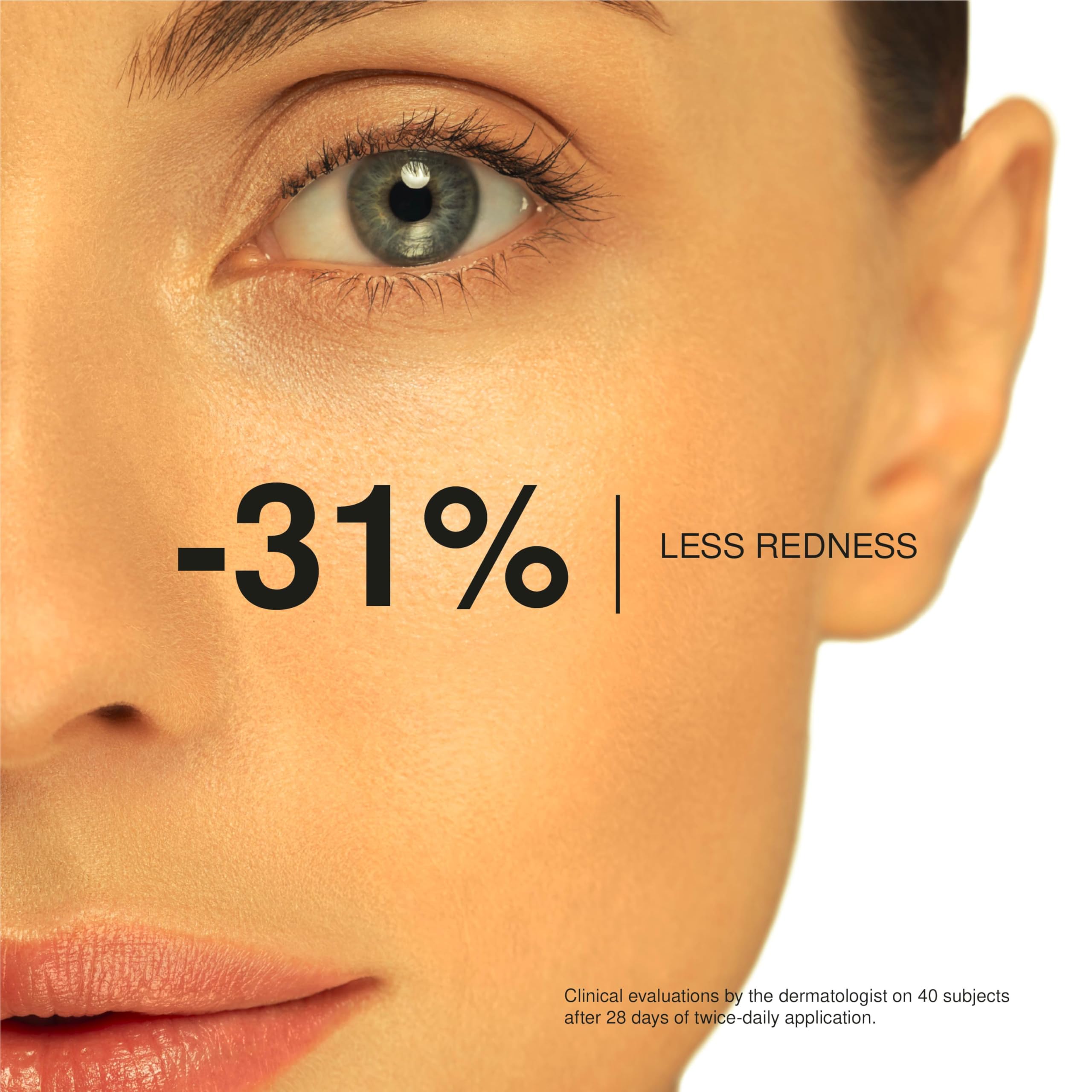 Foto 6 pulgar | Crema Facial Uriage Roseliane Para Aliviar El Enrojecimiento, 40 Ml, Piel Sensible - Venta Internacional.
