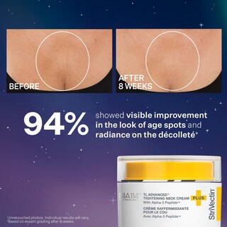 Foto 6 | Kit De Escultura Strivectin Tl Advanced™ Para El Cuidado De La Piel - Venta Internacional.