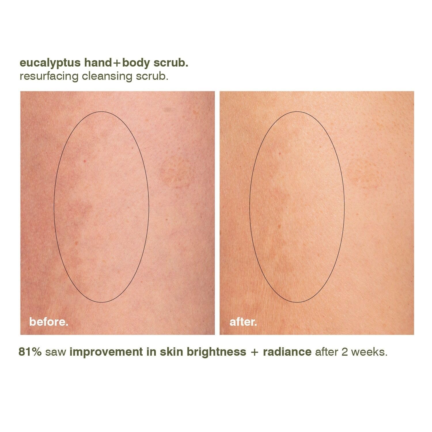 Foto 7 pulgar | Exfoliante Malin+goetz Eucalipto Revitalizante Para Manos Y Cuerpo - Venta Internacional.