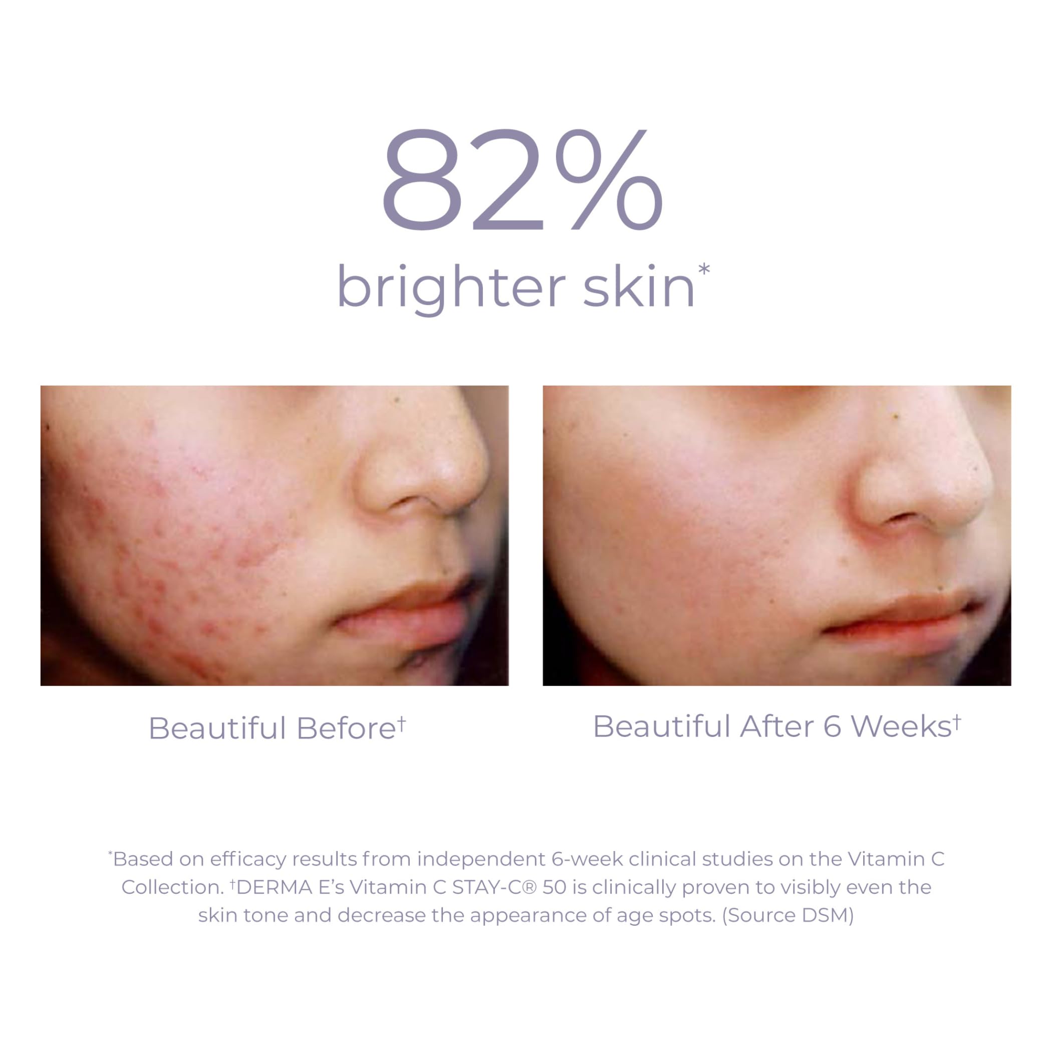 Foto 4 pulgar | Crema Hidratante Derma-e Con Vitamina C, Renovadora E Iluminadora, 60 Ml - Venta Internacional.