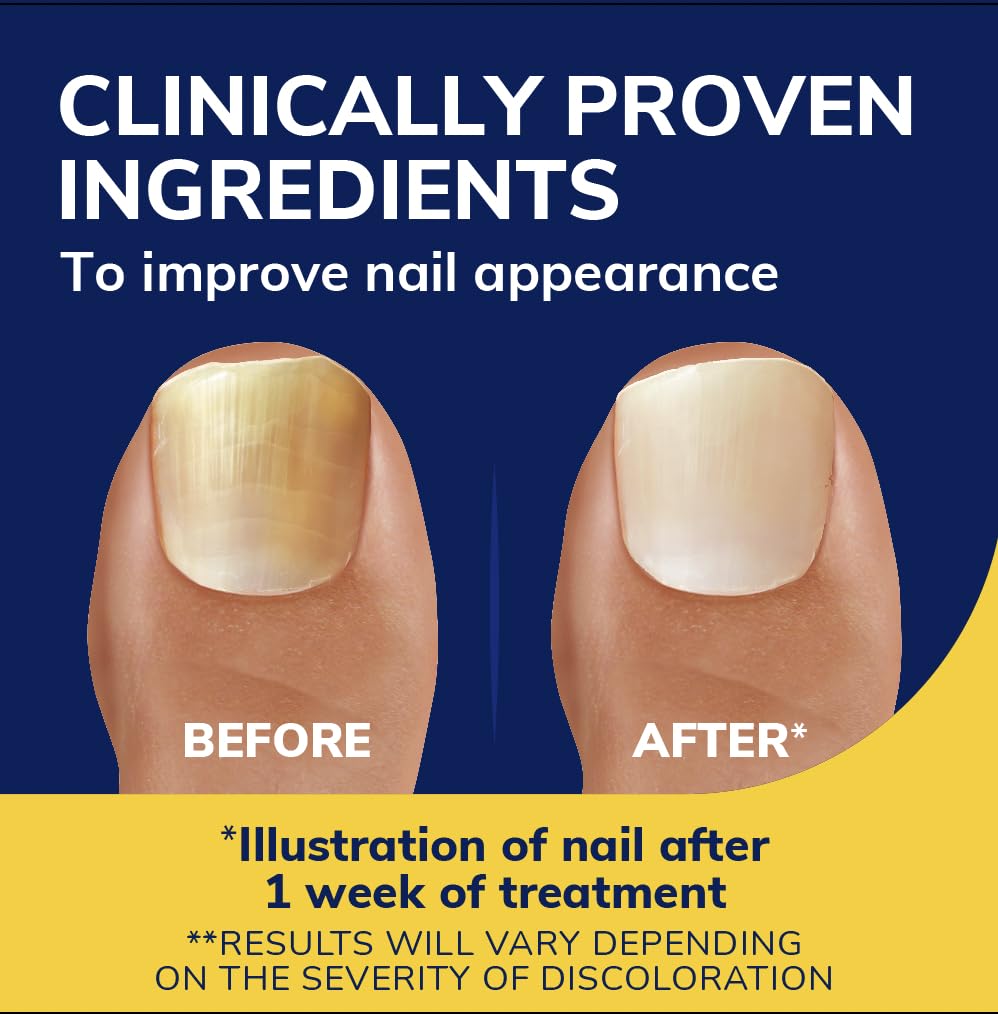 Foto 4 pulgar | Kit De Recarga De Líquido Revitalizador De Uñas Dr. Scholl's Fungal De 10 Ml - Venta Internacional.