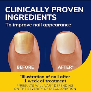 Foto 3 | Kit De Recarga De Líquido Revitalizador De Uñas Dr. Scholl's Fungal De 10 Ml - Venta Internacional.