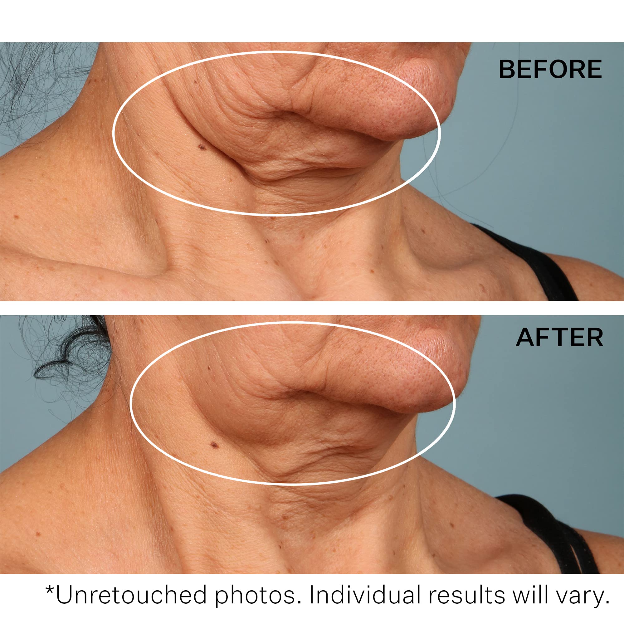 Foto 6 pulgar | Crema De Cuello Strivectin Tl Advanced Tightening 50 Ml - Venta Internacional.