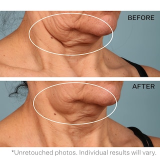 Foto 5 | Crema De Cuello Strivectin Tl Advanced Tightening 50 Ml - Venta Internacional.