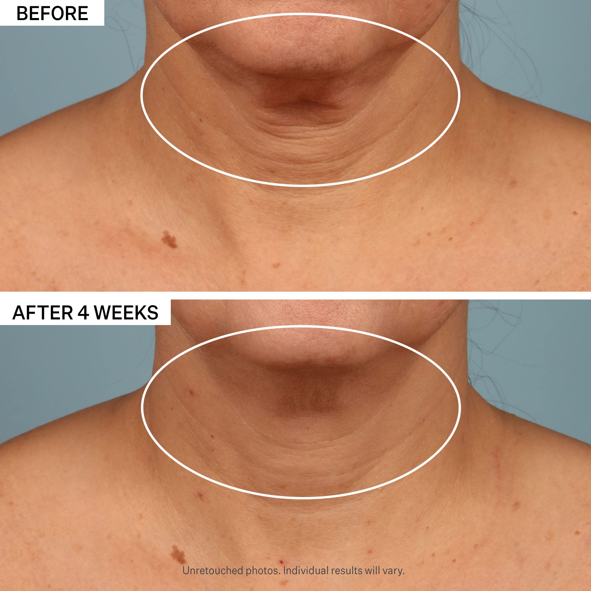 Foto 8 pulgar | Crema De Cuello Strivectin Tl Advanced Tightening 50 Ml - Venta Internacional.