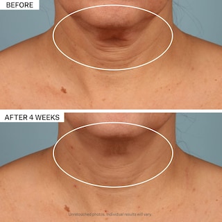 Foto 7 | Crema De Cuello Strivectin Tl Advanced Tightening 50 Ml - Venta Internacional.