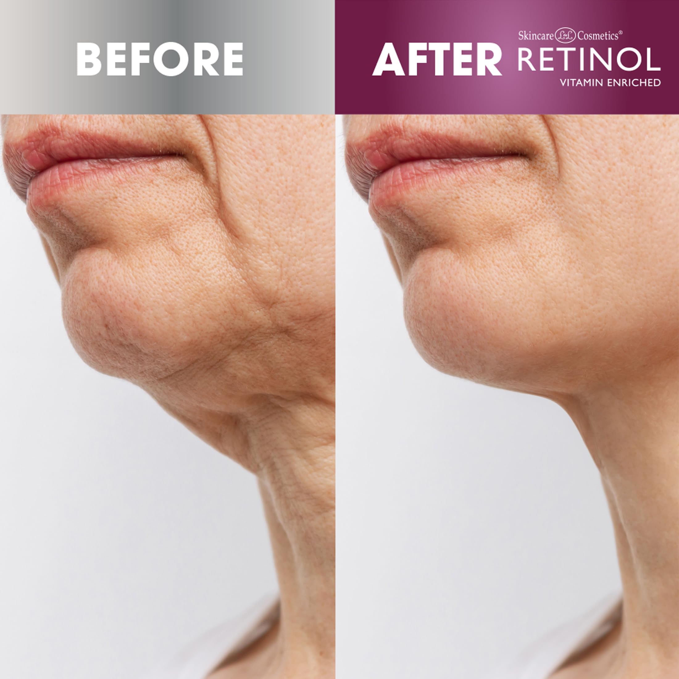 Foto 5 pulgar | Crema Reafirmante Para Cuello Retinol Antiedad 50 Ml - Venta Internacional.