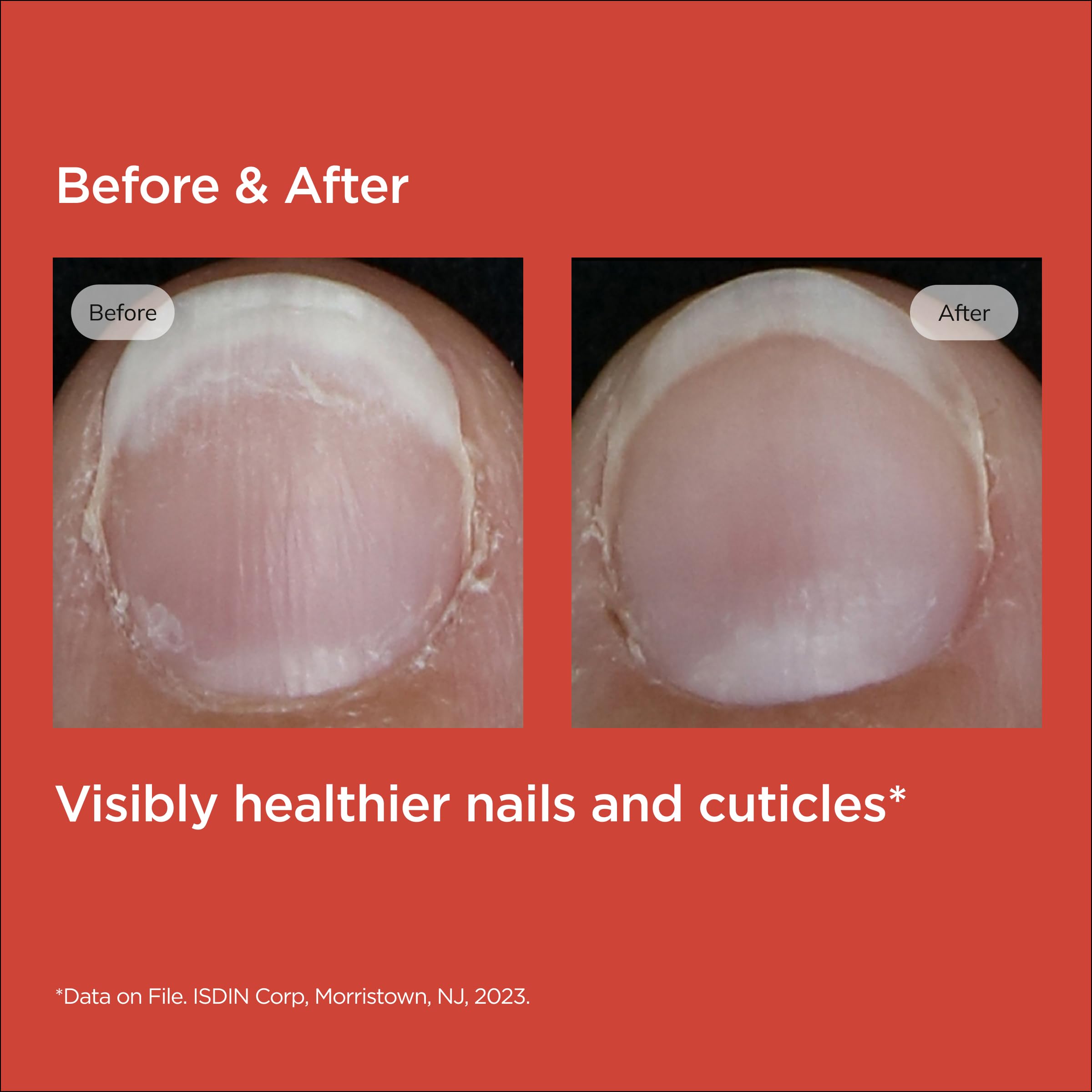 Foto 6 pulgar | Sérum Fortalecedor De Uñas Para Cutículas Isdin Si-nails - Venta Internacional.