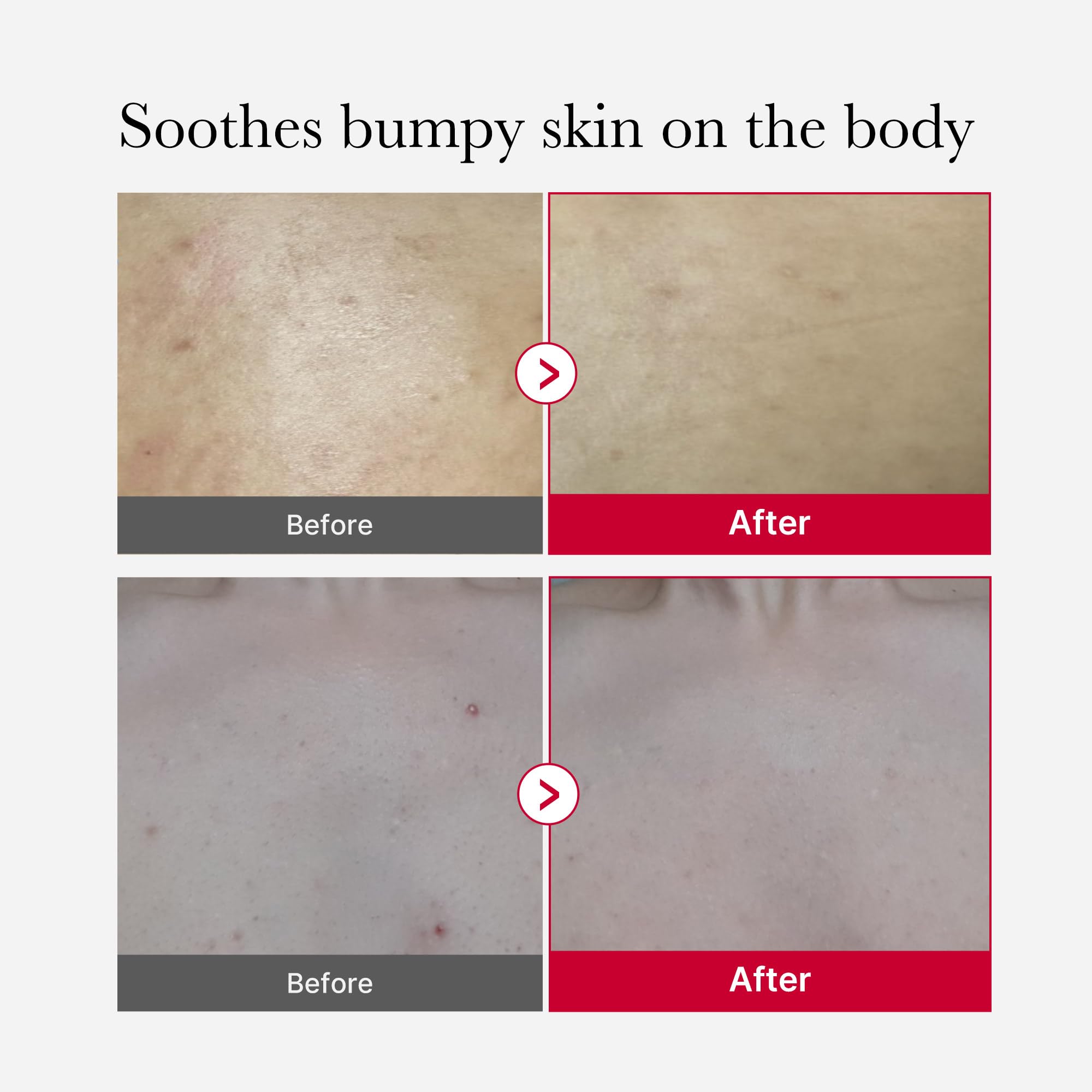 Foto 5 pulgar | Limpiador Corporal Medicube Red Body Peeling Shot 115 Ml - Venta Internacional.