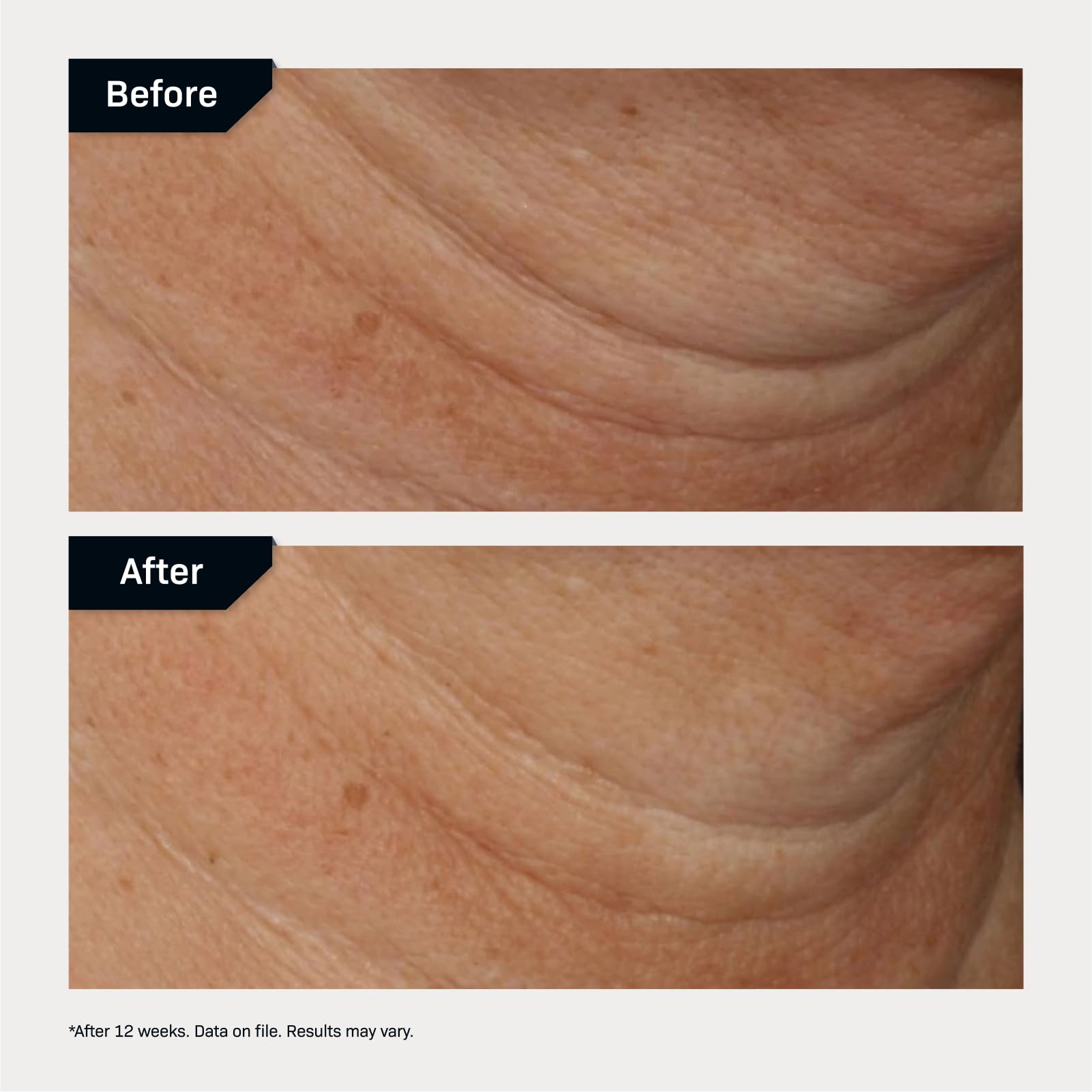 Foto 6 pulgar | Crema Reafirmante Para Cuello Revision Skincare Nectifirm Advanced 50 Ml - Venta Internacional.