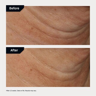 Foto 5 | Crema Reafirmante Para Cuello Revision Skincare Nectifirm Advanced 50 Ml - Venta Internacional.
