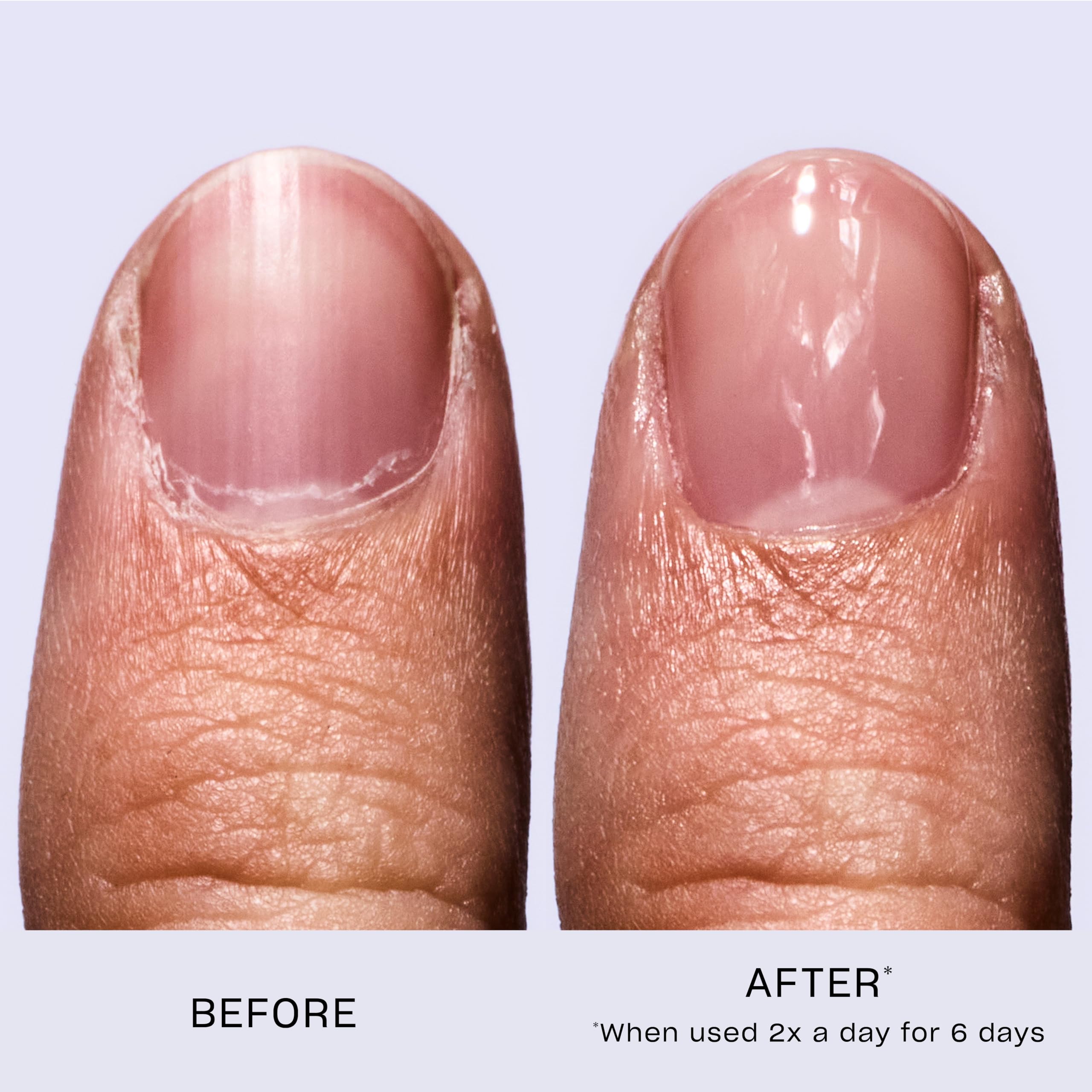 Foto 4 pulgar | Fortalecedor De Uñas Opi Nail Envy Clear Para Uñas Débiles Y Delgadas - Venta Internacional.
