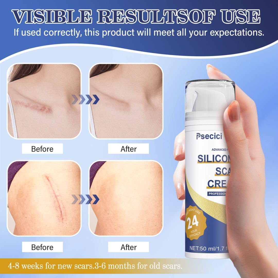 Foto 2 | Crema Para Cicatrices Psecici, Gel De Silicona Para Cicatrices Quirúrgicas, 50 G - Venta Internacional.