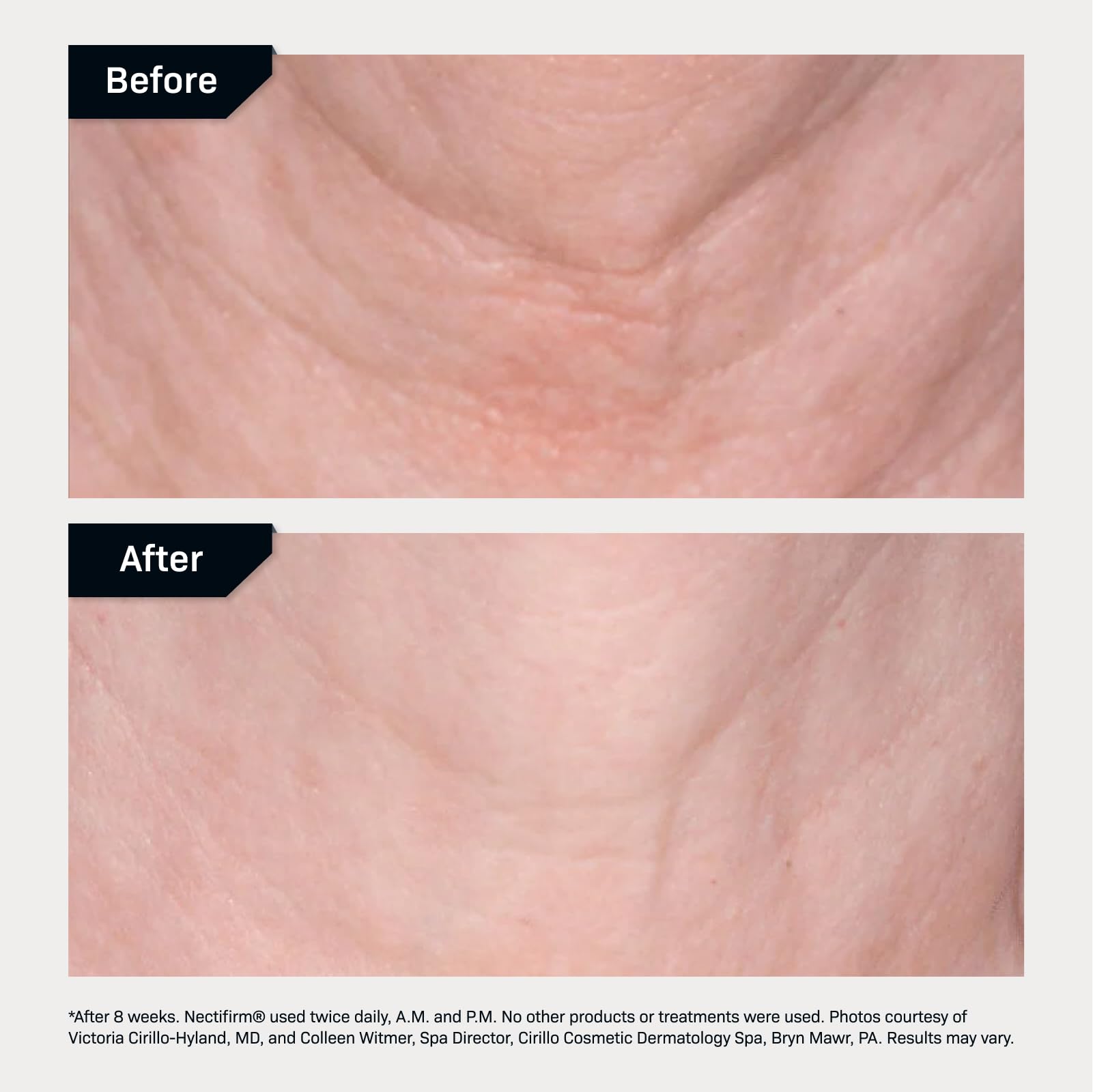 Foto 6 pulgar | Crema Reafirmante Para El Cuello Revision Skincare Nectifirm  Antienvejecimiento 240 Ml - Venta Internacional.