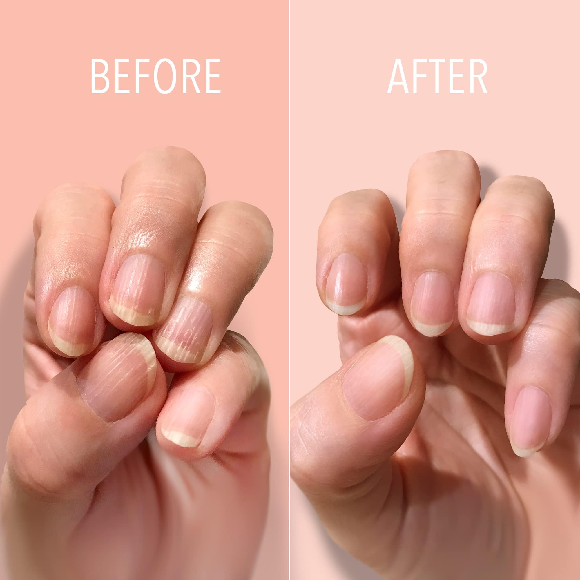 Foto 3 pulgar | Nail Ridge Filler Londontown Kur Smoother Strengener, 12 Ml - Venta Internacional.