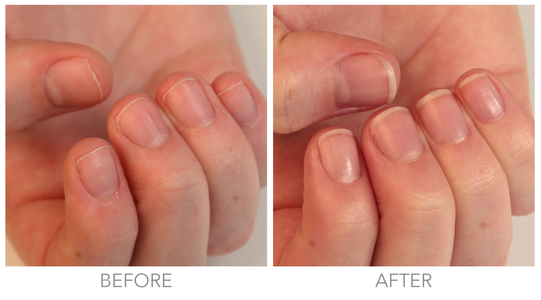 Foto 7 pulgar | Crema De Uñas Londontown Kur Restorative 30 Ml (paquete De 1) - Venta Internacional.