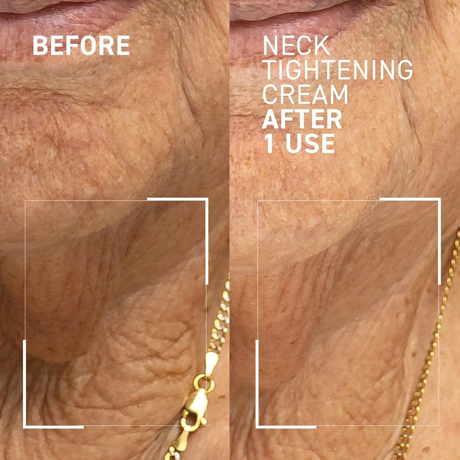 Foto 4 pulgar | Crema Para Reafirmar El Cuello Dr. Brandt Needles No More 50 G/50 Ml - Venta Internacional.