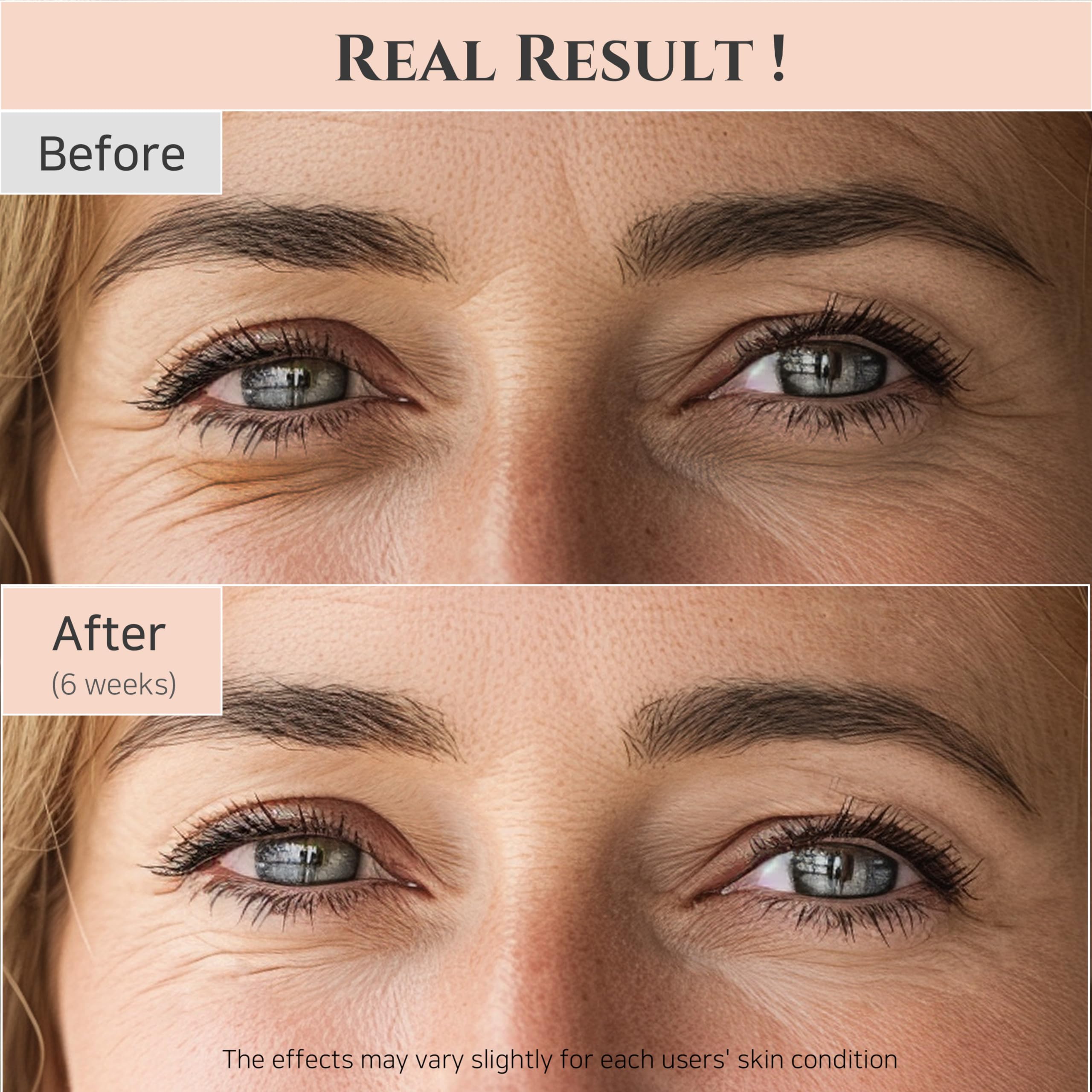 Foto 6 pulgar | Sérum Para Ojos Beauty Of Joseon Revive Con Niacinamida Retiniana 30 Ml - Venta Internacional.