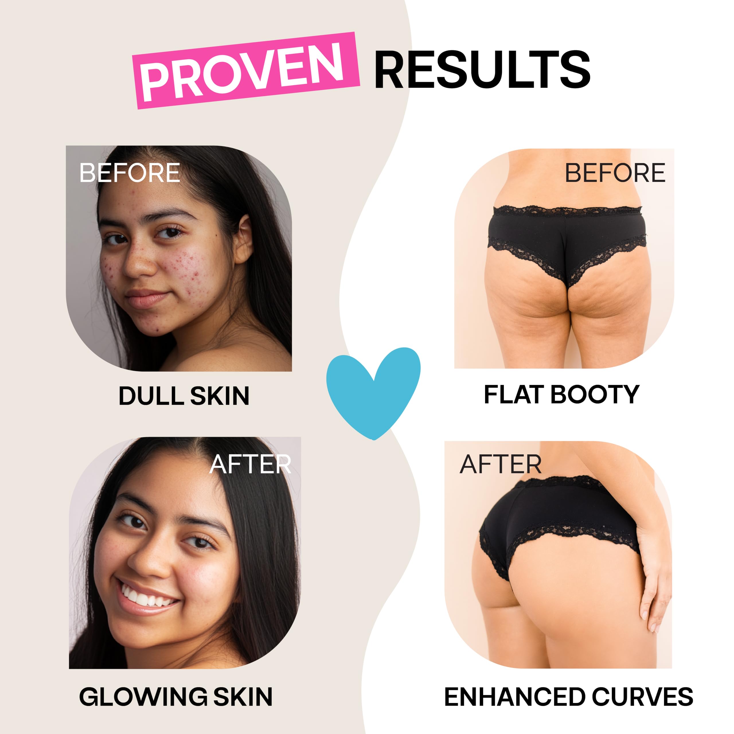 Foto 7 pulgar | Suplemento Amatemas Glute Y Glow Elixir 2 En 1 Para Botines Y Belleza - Venta Internacional.