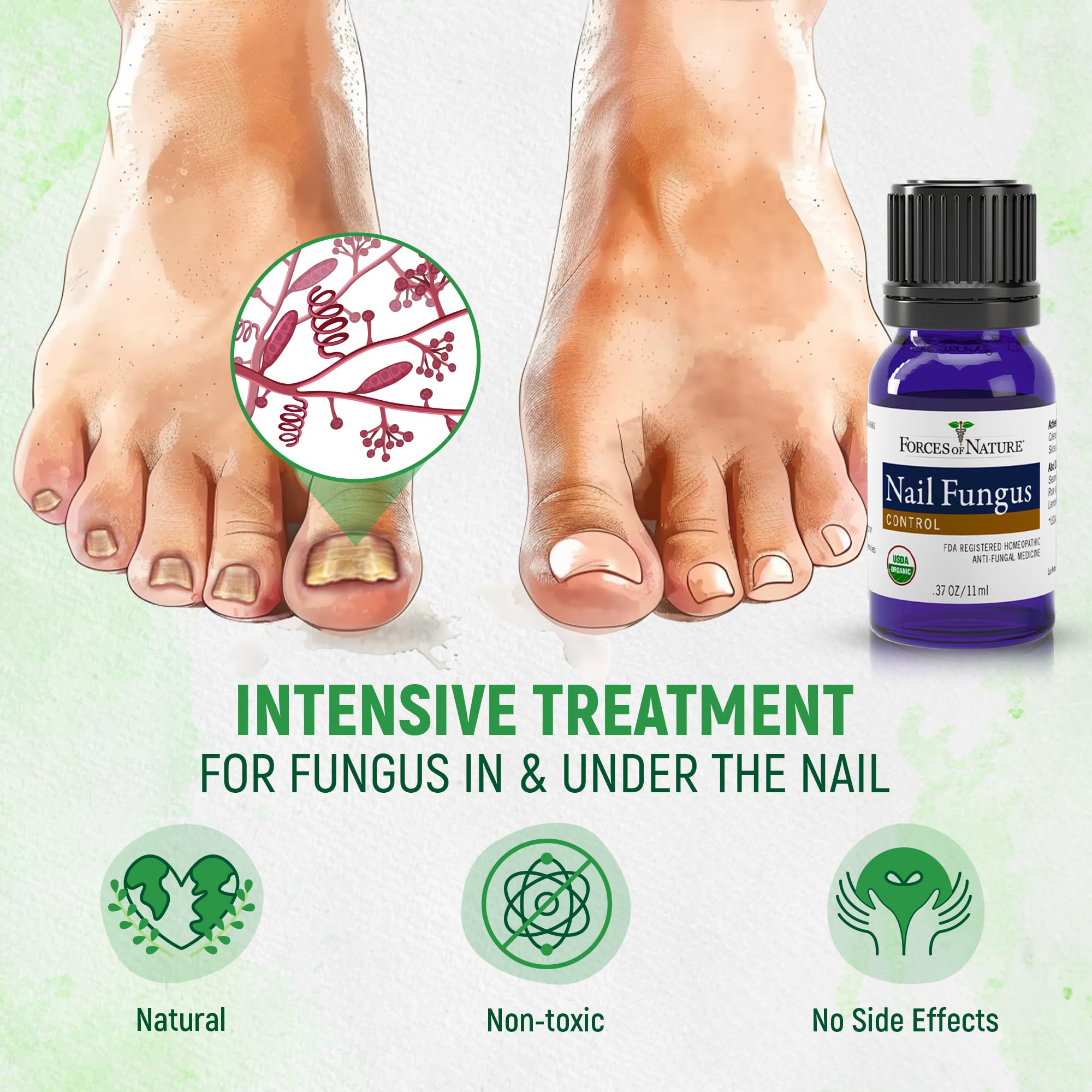 Foto 7 pulgar | Tratamiento De Hongos En Las Uñas De Los Pies Forces Of Nature  11 Ml  Orgánico - Venta Internacional.