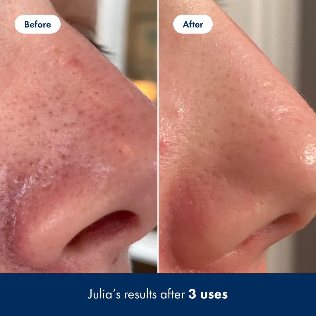 Foto 6 pulgar | Tónico Exfoliante Hero Cosmetics Pore Release 100 Ml - Venta Internacional.