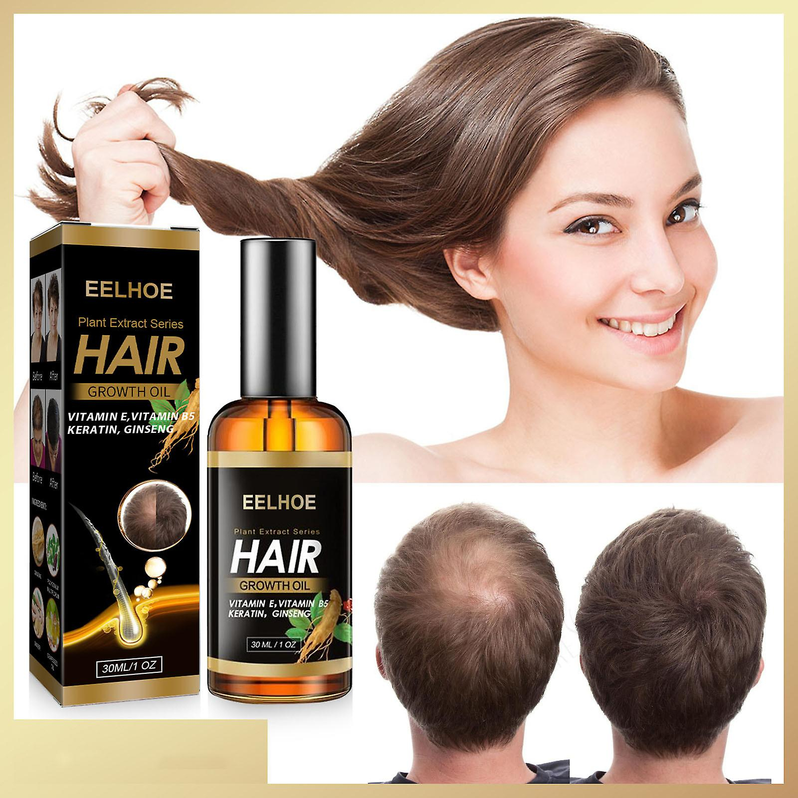 Foto 3 pulgar | El Sérum Para El Crecimiento Del Cabello Huoguo 30 Ml Promueve El Crecimiento Del Cabello Más Grueso - Venta Intern